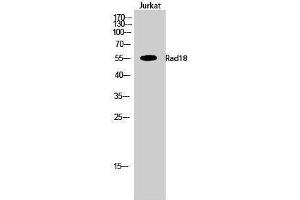 Image no. 1 for anti-E3 ubiquitin-protein ligase RAD18 (RAD18) (Internal Region) antibody (ABIN3186652)