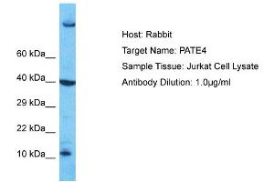 Image no. 1 for anti-Prostate and Testis Expressed 4 (PATE4) (Middle Region) antibody (ABIN2791846)