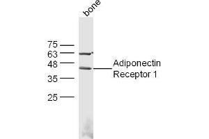 Image no. 3 for anti-Adiponectin Receptor 1 (ADIPOR1) (AA 241-270) antibody (ABIN670836)