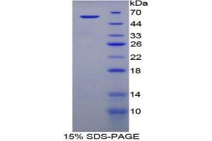 Image no. 1 for Transglutaminase 1, Keratinocyte (TGM1) (AA 496-760) protein (His tag,GST tag) (ABIN1879463)
