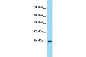 Image no. 1 for anti-Small Ubiquitin Related Modifier 3 (SUMO3) (N-Term) antibody (ABIN2782380)