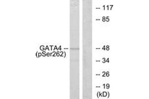 Western blot analysis of extracts from 293 cells, using GATA4 (Phospho-Ser262) Antibody.