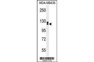 Image no. 1 for anti-Tubulin Tyrosine Ligase-Like Family, Member 13 (TTLL13) (AA 461-490) antibody (ABIN655432)