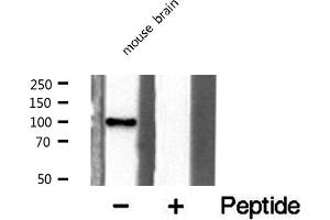 Image no. 1 for anti-K(lysine) Acetyltransferase 2A (KAT2A) (C-Term) antibody (ABIN6258818)