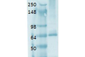 Image no. 2 for anti-Solute Carrier Family 5 (Sodium/iodide Cotransporter), Member 5 (SLC5A5) (AA 468-643) antibody (ABIN863183)