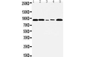 Image no. 2 for anti-Fibroblast Growth Factor Receptor 1 (FGFR1) (AA 806-822), (C-Term) antibody (ABIN3044410)
