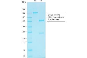 Image no. 6 for anti-Cadherin-16 (CDH16) antibody (ABIN6939024)