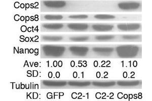 Image no. 12 for anti-SRY (Sex Determining Region Y)-Box 2 (SOX2) (Center) antibody (ABIN2855074)