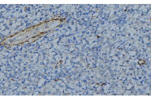 Image no. 1 for anti-Complement Component 1, Q Subcomponent, C Chain (C1QC) (Internal Region) antibody (ABIN6258668)