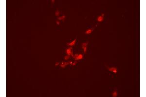 Image no. 4 for anti-Promyelocytic Leukemia (PML) (N-Term) antibody (ABIN6264315)