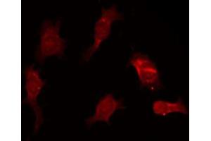 Image no. 3 for anti-Granzyme B (GZMB) antibody (ABIN6262072)