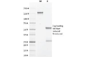 Image no. 4 for anti-Prolactin-Induced Protein (PIP) (AA 41-146) antibody (ABIN6940316)