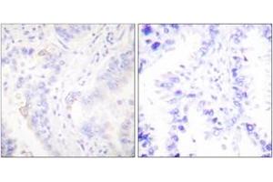 Image no. 2 for anti-V-Crk Sarcoma Virus CT10 Oncogene Homolog (Avian) (CRK) (AA 187-236) antibody (ABIN1532240)