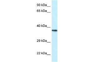Image no. 1 for anti-Proline-serine-threonine Phosphatase Interacting Protein 2 (PSTPIP2) (Middle Region) antibody (ABIN2789007)