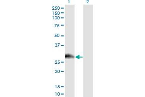 anti-P Antigen Family, Member 1 (Prostate Associated) (PAGE1) (AA 1-146) antibody