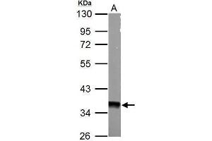 Image no. 1 for anti-Protein Kinase, AMP-Activated, gamma 1 Non-Catalytic Subunit (PRKAG1) (Center) antibody (ABIN2855115)
