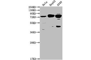 Recombinant HTR2C antibody