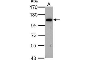 Image no. 1 for anti-Oxysterol Binding Protein-Like 6 (OSBPL6) (C-Term) antibody (ABIN2856531)