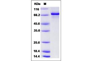 Image no. 1 for Checkpoint Kinase 1 (CHEK1) (AA 1-476) protein (GST tag,His tag) (ABIN2007565)