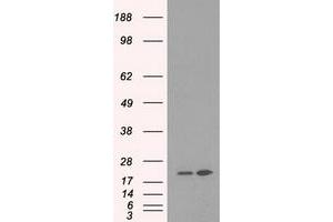 Image no. 5 for anti-Dihydrofolate Reductase (DHFR) antibody (ABIN1497822)