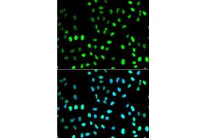 Image no. 1 for anti-Small Ubiquitin Related Modifier Protein 1 (SUMO1) antibody (ABIN3022994)