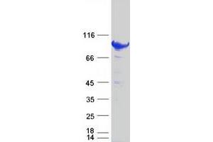 Image no. 1 for Signal Transducer and Activator of Transcription 5B (STAT5B) protein (Myc-DYKDDDDK Tag) (ABIN2732827)