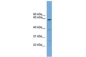 Image no. 1 for anti-Proteasome (Prosome, Macropain) 26S Subunit, Non-ATPase, 3 (PSMD3) (Middle Region) antibody (ABIN2786727)