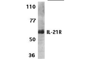 Image no. 1 for anti-Interleukin 21 Receptor (IL21R) (N-Term) antibody (ABIN1031410)