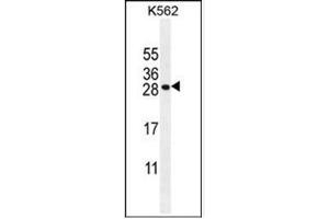 Image no. 2 for anti-Transcription Factor 21 (TCF21) (AA 151-179), (C-Term) antibody (ABIN955127)