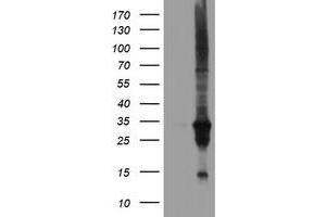 Image no. 5 for anti-Dual Specificity Phosphatase and Pro Isomerase Domain Containing 1 (DUPD1) antibody (ABIN1497927)