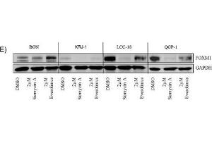 Image no. 62 for anti-Glyceraldehyde-3-Phosphate Dehydrogenase (GAPDH) (Center) antibody (ABIN2857072)