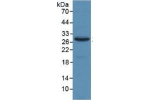 Image no. 4 for alpha-2-Macroglobulin (A2M) ELISA Kit (ABIN6574245)