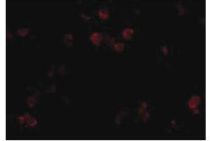 Image no. 3 for anti-CD81 (CD81) (N-Term) antibody (ABIN6657057)