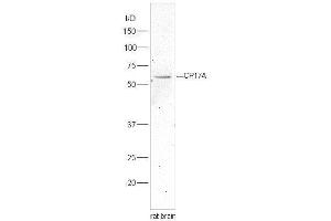 anti-Cytochrome P450, Family 17, Subfamily A, Polypeptide 1 (CYP17A1) (AA 24-65) antibody