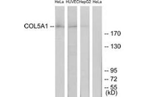 COL5A1 antibody  (AA 301-350)