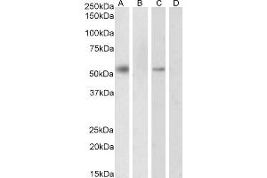 Image no. 4 for anti-Retinoid X Receptor, alpha (RXRA) (Internal Region) antibody (ABIN185295)
