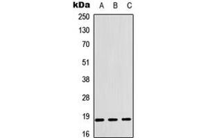 Image no. 2 for anti-Cofilin 1 (CFL1) (Center) antibody (ABIN2972845)