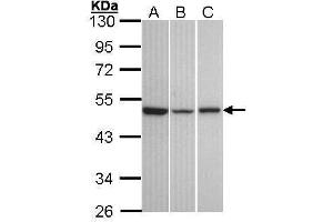 WB Image Sample (30 ug of whole cell lysate) A: A431 , B: Hela C: Hep G2 , 10% SDS PAGE antibody diluted at 1:1000