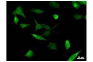 Image no. 2 for anti-Upstream Binding Protein 1 (LBP-1a) (UBP1) antibody (ABIN931121)