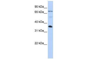 Image no. 1 for anti-LIM and SH3 Protein 1 (LASP1) (C-Term) antibody (ABIN630939)