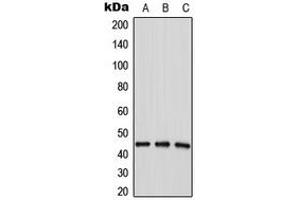 Image no. 1 for anti-1-Acylglycerol-3-Phosphate O-Acyltransferase 4 (AGPAT4) (Center) antibody (ABIN2706481)