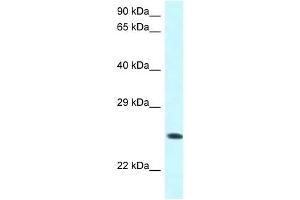 Image no. 1 for anti-WW Domain Containing Oxidoreductase (WWOX) (C-Term) antibody (ABIN926732)