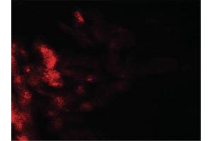 Image no. 1 for anti-Complement Decay-Accelerating Factor (CD55) (C-Term) antibody (ABIN6655329)