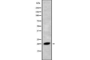 Image no. 1 for anti-Ring Finger Protein 5, E3 Ubiquitin Protein Ligase (RNF5) (C-Term) antibody (ABIN6264790)