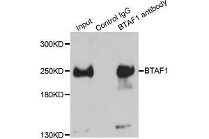 Image no. 2 for anti-TBP-Associated Factor 172 (BTAF1) antibody (ABIN6137676)