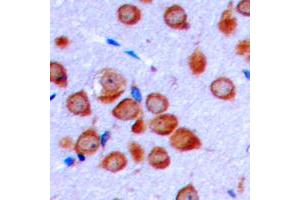 Image no. 2 for anti-Olfactomedin-Like 2B (OLFML2B) (Center) antibody (ABIN2706733)