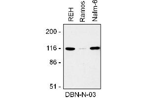 Image no. 1 for anti-Drebrin 1 (DBN1) (AA 1-326) antibody (PE) (ABIN1558085)