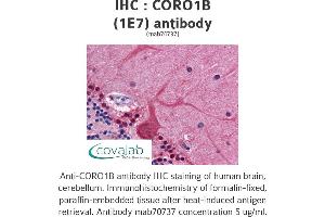 Image no. 3 for anti-Coronin, Actin Binding Protein, 1B (CORO1B) (AA 1-490), (full length) antibody (ABIN1723594)