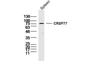 Image no. 1 for anti-Mediator Complex Subunit 17 (MED17) (AA 181-280) antibody (ABIN1387677)