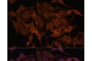 Immunofluorescence analysis of HeLa cells using TLR3 Polyclonal Antibody at dilution of 1:100.